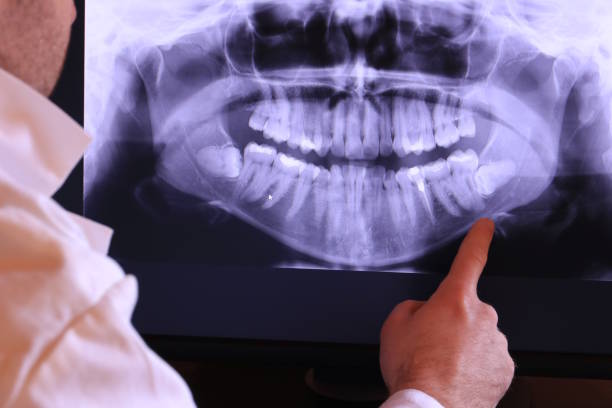 Best Cracked Tooth Emergency Dentist  in Powell, AL