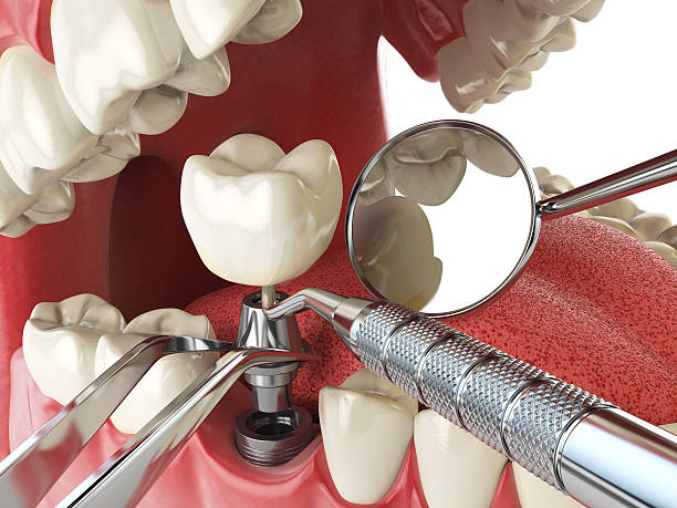 Best Dentist for Dental Trauma  in Powell, AL
