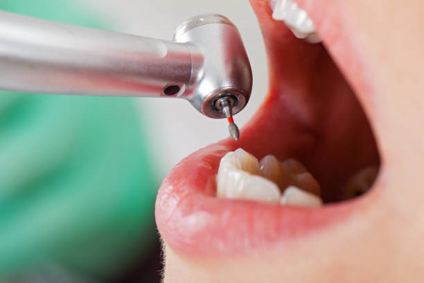 Tooth Infection Emergency Dentist in AL